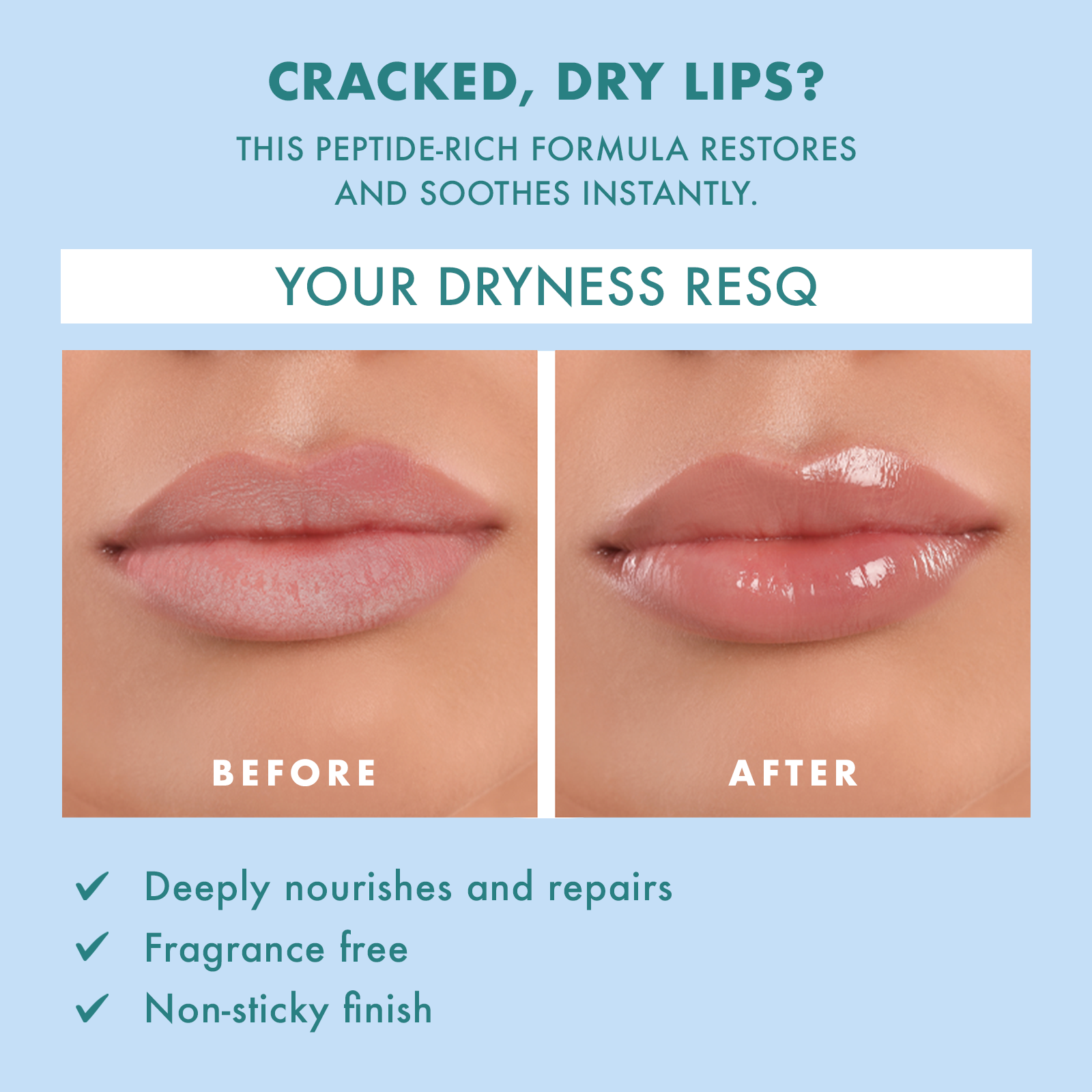 Skin ResQ Hello Hydration Multi-Peptide Lip Treatment, 0.35oz