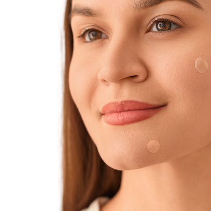 Skin ResQ Invisible Daytime Pimple Patches – Jumbo Pack (108 Count)