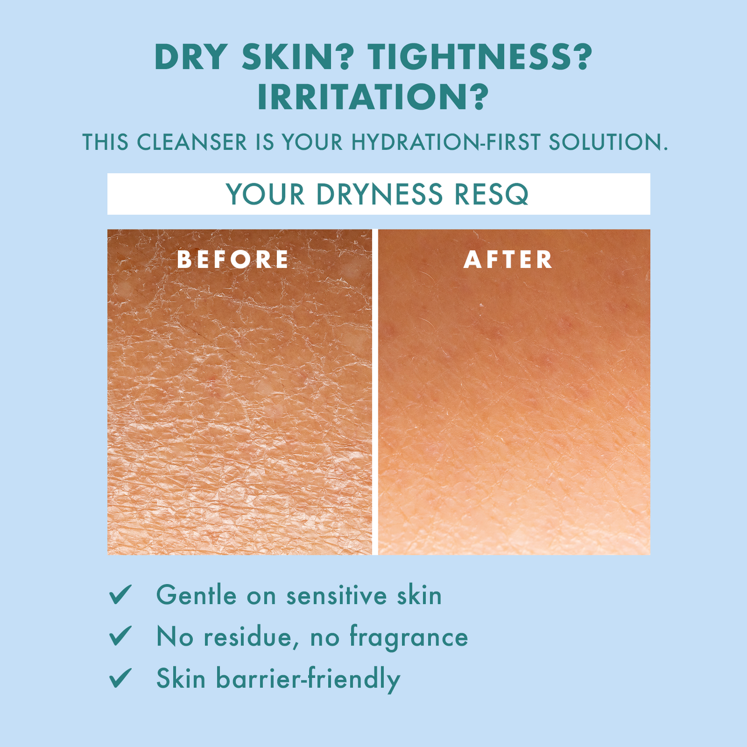 Skin ResQ Hello Hydration Facial Cleanser, 10oz