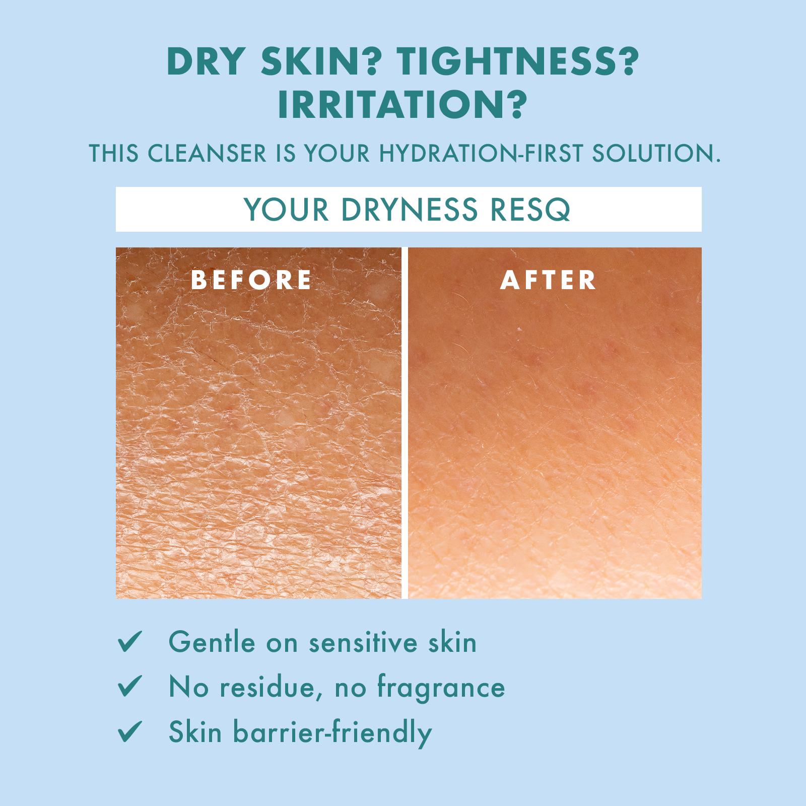 Skin ResQ Hello Hydration Facial Cleanser, 10oz