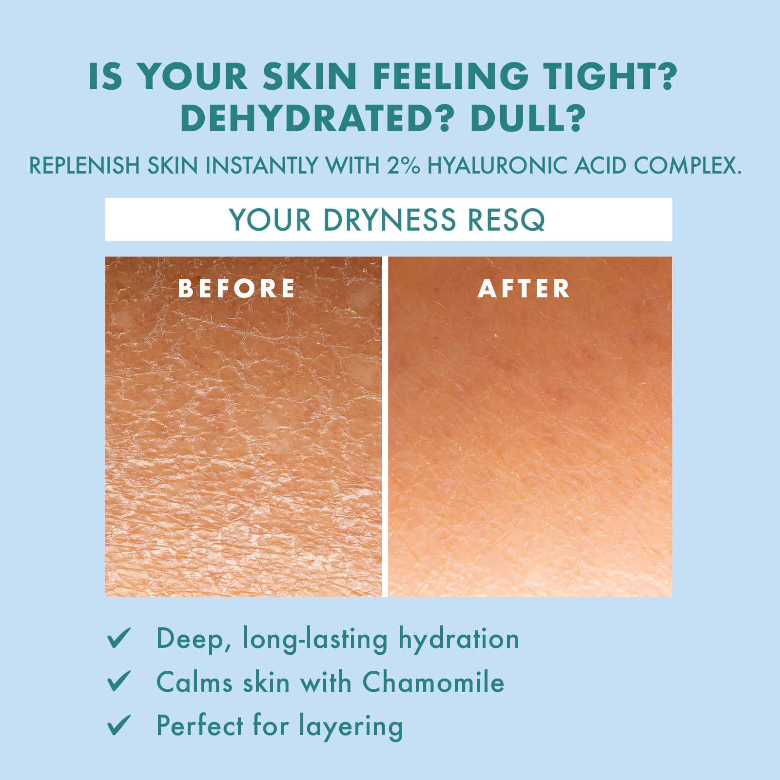 Skin ResQ Hello Hydration Facial Serum, 2oz