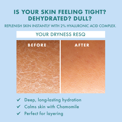 Skin ResQ Hello Hydration Facial Serum, 2oz