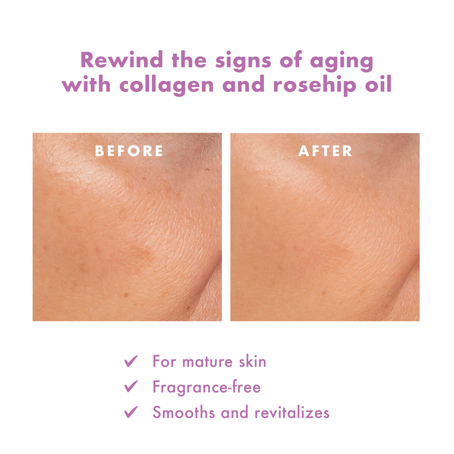 Skin ResQ Age Rewind Sheet Mask, Jumbo 7-Pack