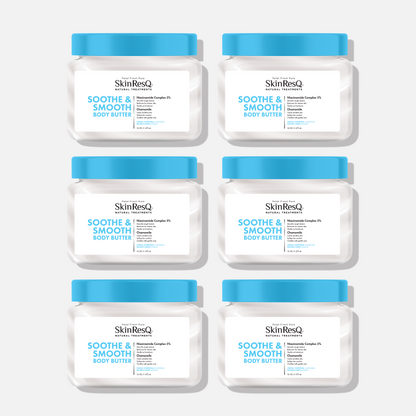 Skin ResQ Soothe &amp; Smooth Body Butter, 16oz